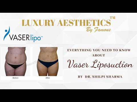 Everything You Need To Know About Vaser Liposuction