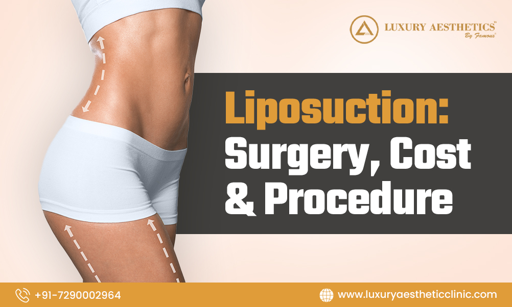You are currently viewing Liposuction: Surgery, Cost & Procedure